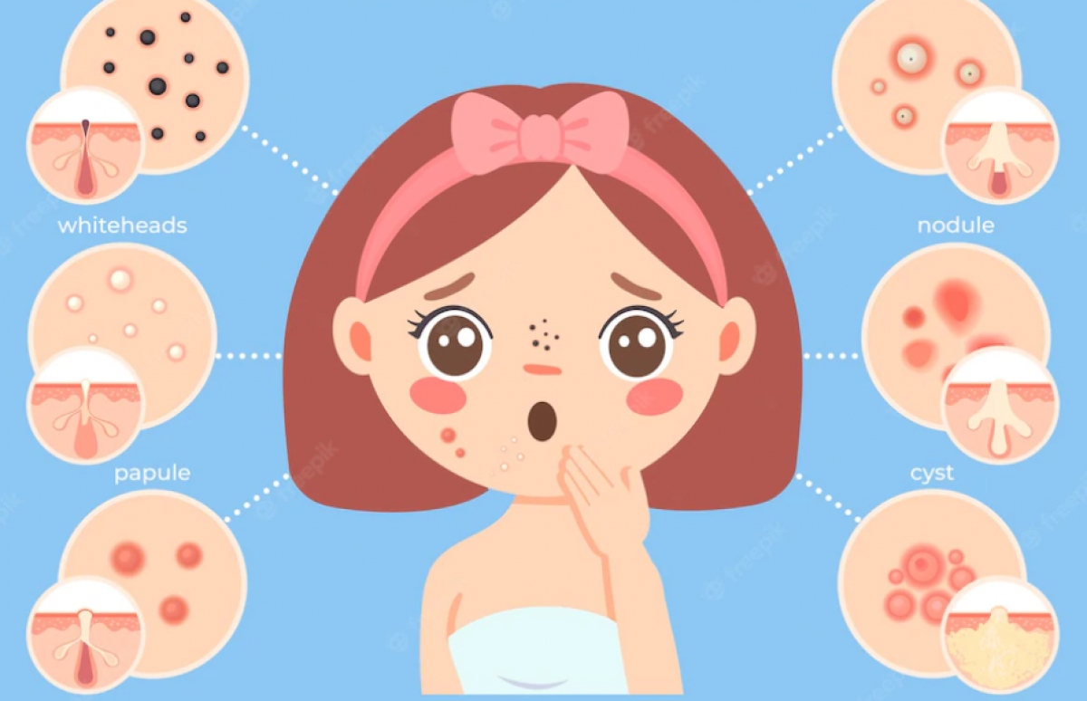 những hiểm họa khôn lường khi trẻ dậy thì sớm hình ảnh 1 nhung hiem hoa khon luong khi tre day thi som hinh anh 1