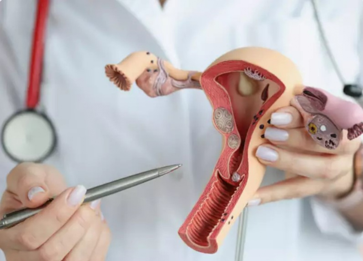 Điều gì giết chết ham muốn tình dục của phụ nữ hình ảnh 1 Dieu gi giet chet ham muon tinh duc cua phu nu hinh anh 1