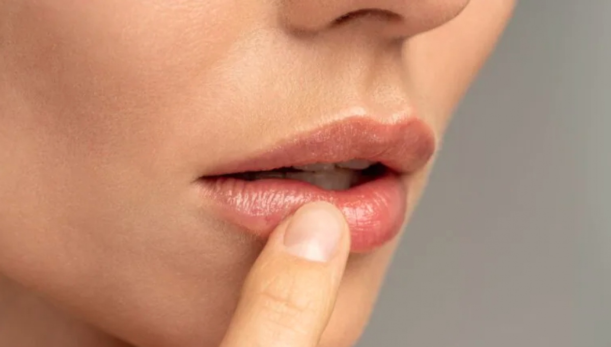 cách loại bỏ đôi môi nứt nẻ trong mùa đông hình ảnh 1 cach loai bo doi moi nut ne trong mua dong hinh anh 1