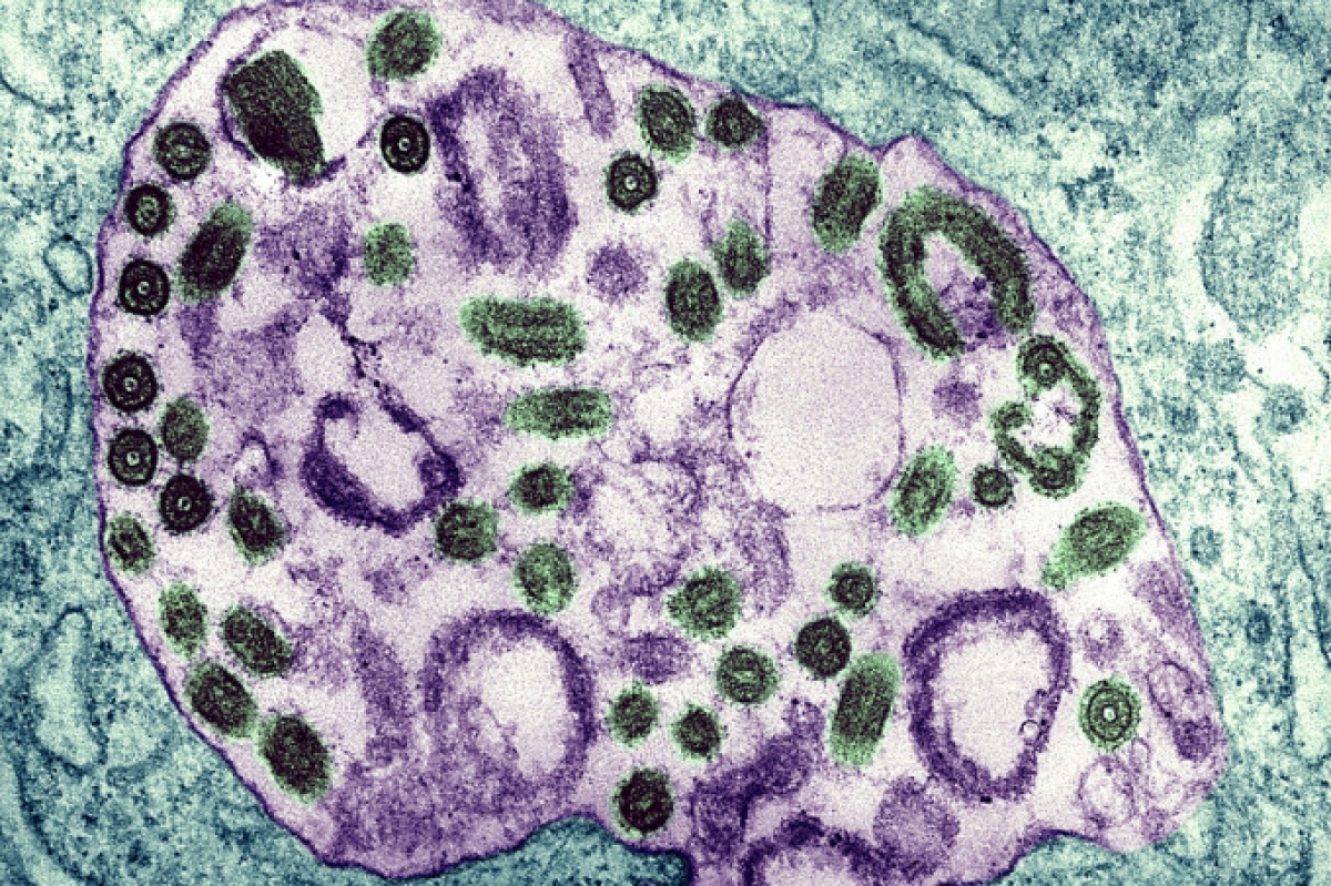 loại virus khiến 9 người chết sau khi đi dự đám tang hình ảnh 1 loai virus khien 9 nguoi chet sau khi di du dam tang hinh anh 1