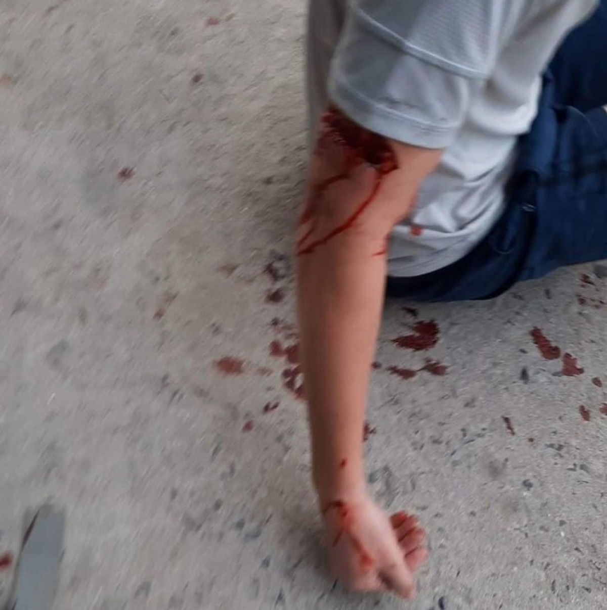 nha trang tieu huy con cho du can du khach nuoc ngoai nhap vien hinh anh 2