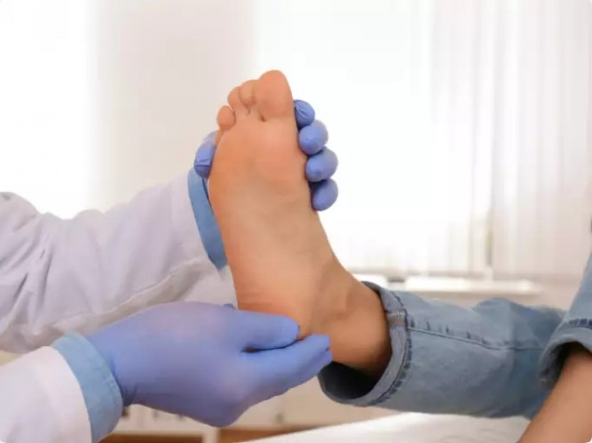 Đỏ và sưng: Còn được gọi là biến dạng bàn chân do tiểu đường, tình trạng này có thể gây gãy xương và trật khớp ở bàn chân do xương yếu và tổn thương khớp. Các triệu chứng bao gồm đỏ, sưng và biến dạng ở bàn chân hoặc mắt cá chân.