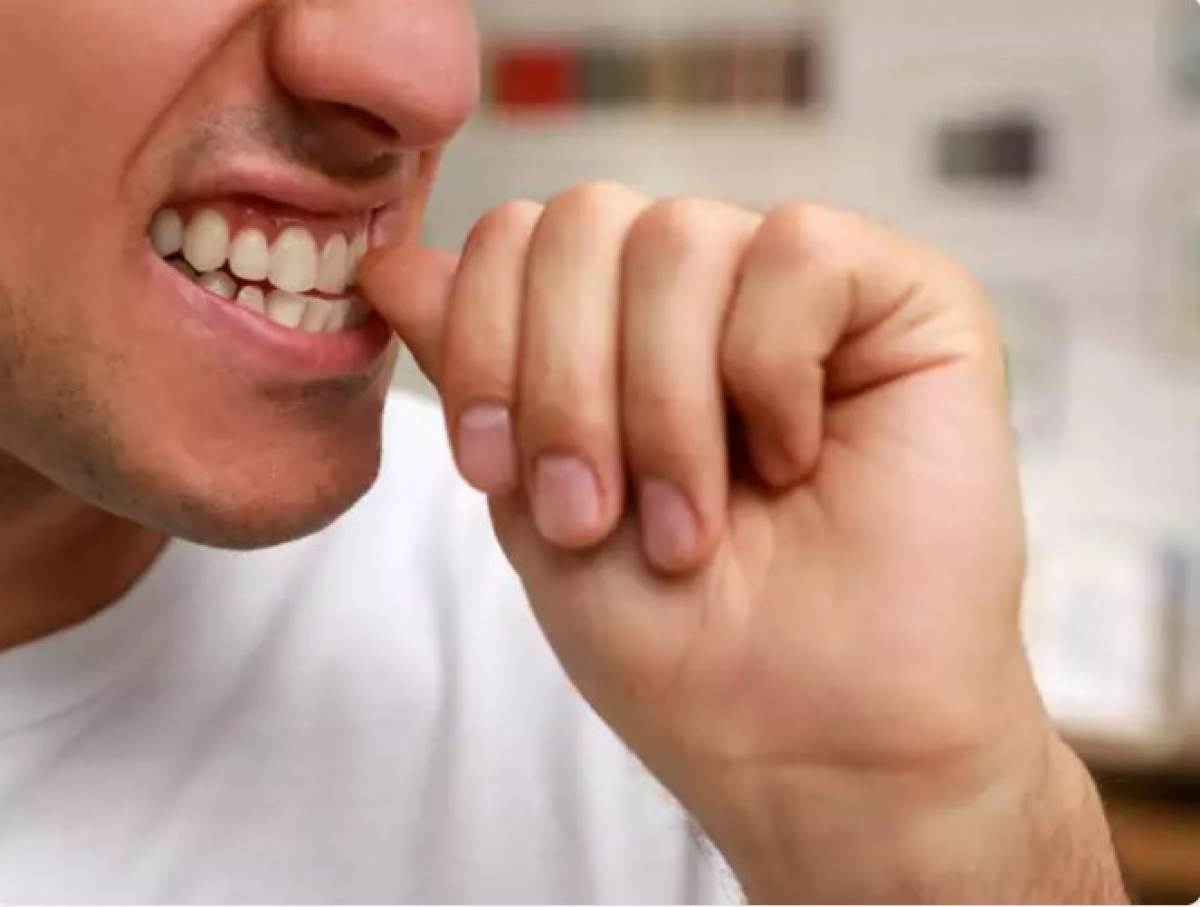 Nhiều người cho rằng, việc cắn móng tay giúp họ điều chỉnh cảm xúc. Theo Hiệp hội Nha khoa Hoa Kỳ, cắn móng tay có thể làm sứt mẻ hoặc nứt răng. Nếu bạn đang niềng răng, thì việc cắn móng tay cũng có thể làm tăng nguy cơ tiêu chân răng và mất răng.