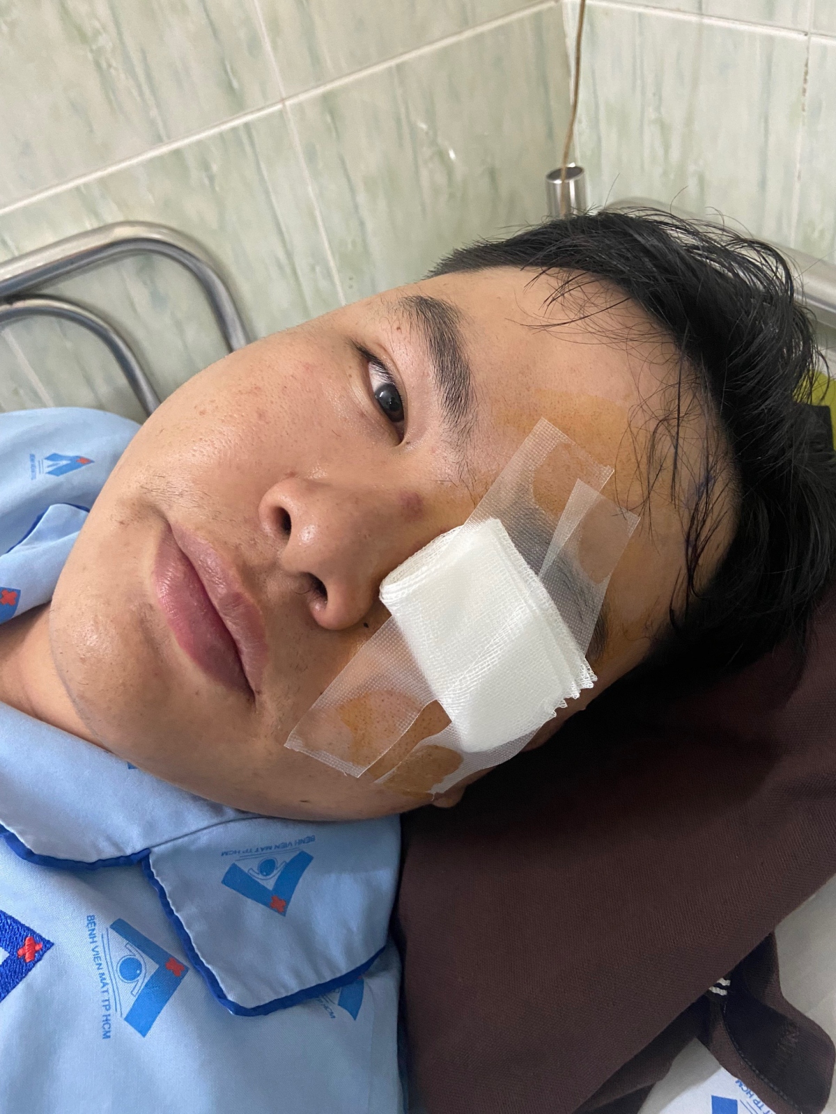 Hôm nay (22/8), đại diện Phòng Cảnh sát giao thông đường bộ - đường sắt Công an TP.HCM (PC08) cho biết, đơn vị đã mời người thanh niên tố bị cảnh sát giao thông "tác động" làm tổn thương mắt, đến trụ sở để phối hợp làm rõ vụ việc