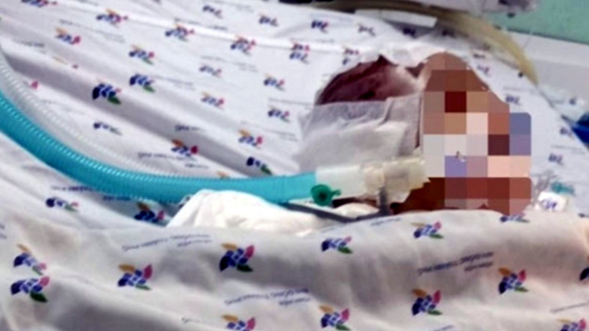 Hình ảnh lúc bé H.A được chăm sóc đặc biệt ở BV Nhi đồng Thành phố