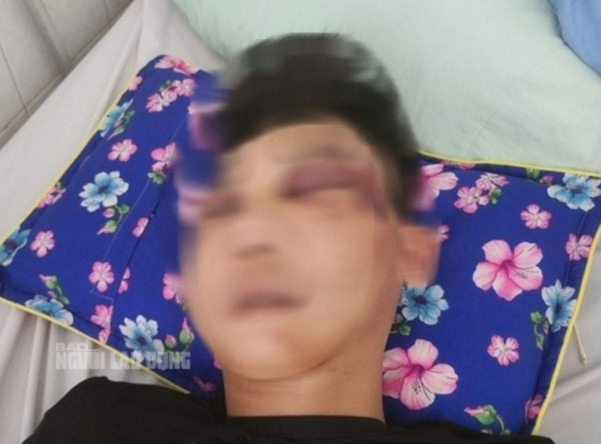 Người đàn ông trong tình trạng lơ mơ, có nhiều vết thương trên mặt.