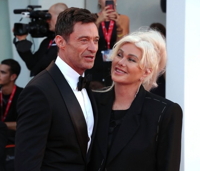 Theo People, Hugh Jackman - Deborra-Lee Furness chính thức ly thân sau 27 năm kết hôn. Cặp đôi xác nhận chia tay trong hòa bình thông qua tuyên bố chung. Việc Hugh Jackman - Deborra-Lee Furness thông báo ly thân khiến công chúng ngỡ ngàng bởi cặp sao người Úc đã bên nhau gần 30 năm và có một tổ ấm được ngưỡng mộ bậc nhất làng giải trí. 