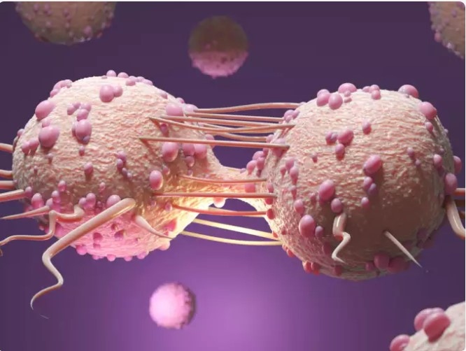 Làm thế nào được chẩn đoán sarcoma xương? Sarcoma xương là một loại ung thư đòi hỏi nhiều xét nghiệm khác nhau để chẩn đoán chính xác, mặc dù không phải tất cả các xét nghiệm đều cần thiết cho mỗi cá nhân. Khi lựa chọn các xét nghiệm chẩn đoán, bác sĩ sẽ tính đến một số yếu tố như loại ung thư nghi ngờ, các dấu hiệu và triệu chứng của bệnh nhân, tuổi tác, sức khỏe tổng quát và kết quả của các xét nghiệm y tế trước đó. Dưới đây là các xét nghiệm thường được sử dụng để chẩn đoán và xác định giai đoạn của sarcoma xương.