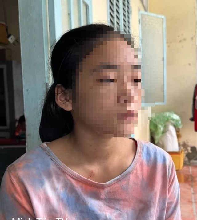Em N.T.B.V, người bị Lê Thị Kiểu hành hạ