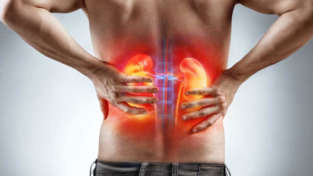 Tăng nguy cơ mắc bệnh sỏi thận: Các loại soda (nước ngọt) chứa axit photphoric có thể làm thay đổi thành phần nước tiểu, tăng nguy cơ sỏi thận và bệnh thận mạn tính. Do đó, khuyến nghị của nhiều cơ quan y tế là yêu cầu người bị sỏi thận hoặc bệnh thận cần tránh uống soda.