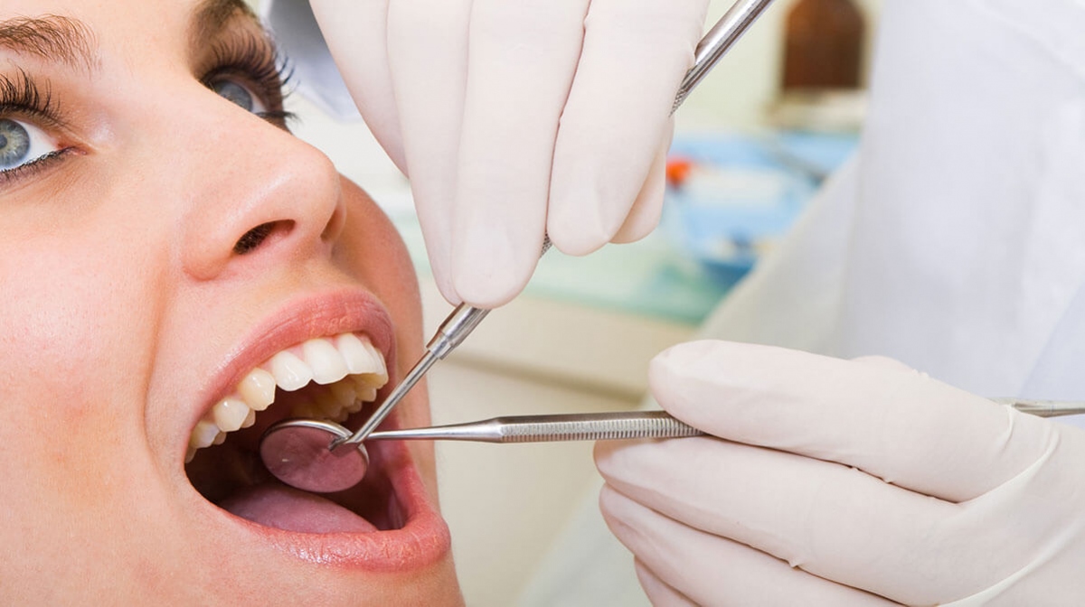Gây sâu răng: Răng dễ bị sâu khi tiếp xúc với lượng đường lớn trong nước ngọt. Đường và axit trong soda có thể ăn mòn men răng, lớp ngoài cùng của răng, dẫn đến sâu răng.