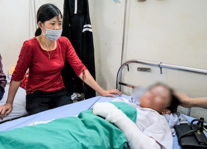 Em Q. bị bỏng ở mặt, tay cũng đang phải băng bó.