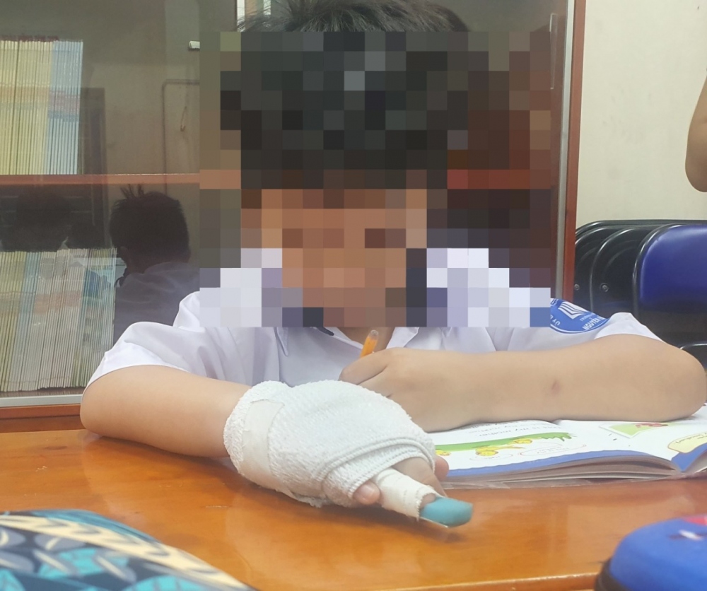 Học sinh bị hãy ngón tay ở trường Tiểu học Nguyễn Văn Trỗi (Ảnh: C.P)