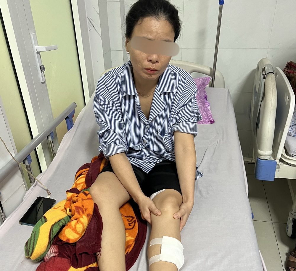Nữ nhân viên bị đạn bắn vào đùi và chân
