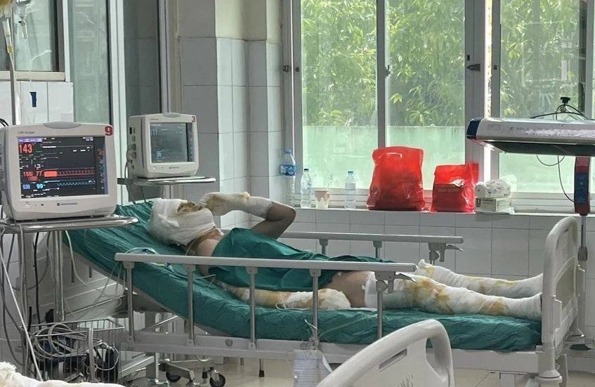 Chủ cơ sở là anh M.V.Y. (SN 1988, quê tại Xuân Trường, Nam Định) bị thương sau vụ cháy