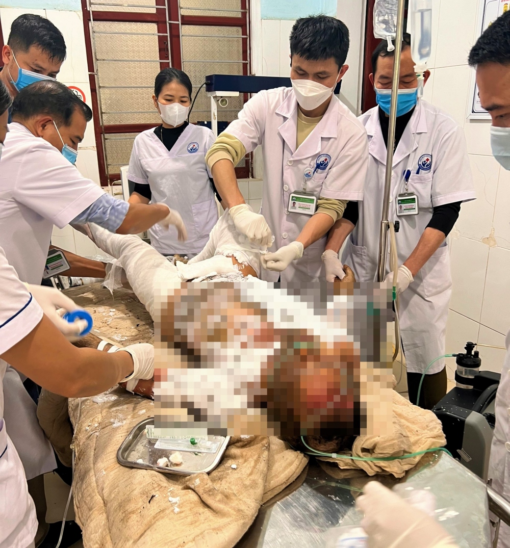  Anh X đang được cấp cứu tại bệnh viện trong tình trạng bị bỏng nặng
