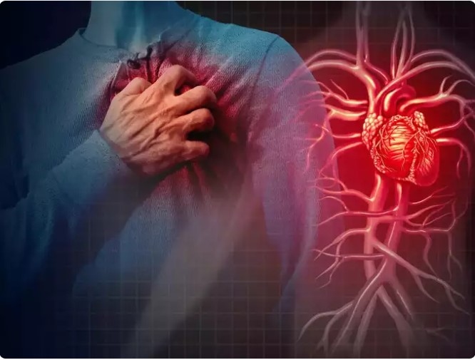 Điều kiện báo động: Việc tạo mảng xơ vữa động mạch cuối cùng có thể dẫn đến đau tim hoặc các bệnh về tim theo truyền thống chỉ được điều trị bằng cách thực hiện các phẫu thuật bắc cầu được gọi là nong mạch vành. Tuy nhiên, qua nhiều năm, câu chuyện đã thay đổi và các chuyên gia hiện đang đề xuất liệu pháp giải độc và các cách tự nhiên để chống lại cũng như đẩy lùi bệnh tim và ngăn ngừa các cơn đau tim.