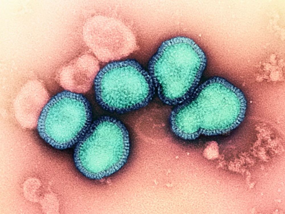 Virus H3N2 dưới kính hiển vi. Ảnh: NIAID