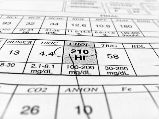 Cung giác mạc: Tương tự như arcus senilis, cung giác mạc biểu hiện dưới dạng một vòng màu trắng hoặc xám bao quanh giác mạc. Nó có thể là một dấu hiệu rõ ràng về sự tích tụ cholesterol và thường được quan sát thấy ở những người lớn tuổi. Sự hiện diện của nó ở những người trẻ tuổi thì phải kiểm tra cholesterol ngay lập tức.