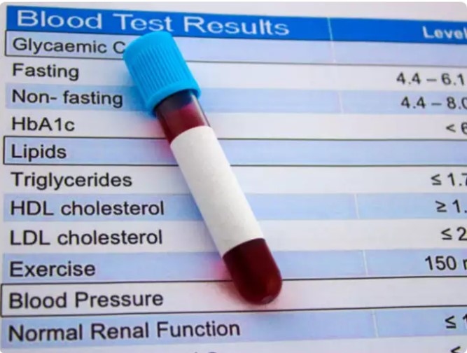 Điều gì khiến mức cholesterol tăng lên? Một số yếu tố góp phần gây ra cholesterol cao, bao gồm di truyền, tuổi tác, chế độ ăn uống và lối sống. Nếu đó là di truyền sẽ khiến các cá nhân có mức cholesterol cao hơn, trong khi tuổi tác có xu hướng làm tăng nguy cơ vì mức cholesterol tăng tự nhiên theo tuổi tác. Áp dụng chế độ ăn nhiều chất béo bão hòa và chất béo chuyển hóa, thiếu hoạt động thể chất và hút thuốc là những yếu tố nguy cơ có thể thay đổi được và có thể tác động đáng kể đến mức cholesterol.