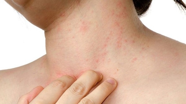 Vào những thời điểm giao mùa, cơ thể chúng ta tiếp xúc với sự thay đổi của môi trường gây ra hiện tượng dị ứng thời tiết