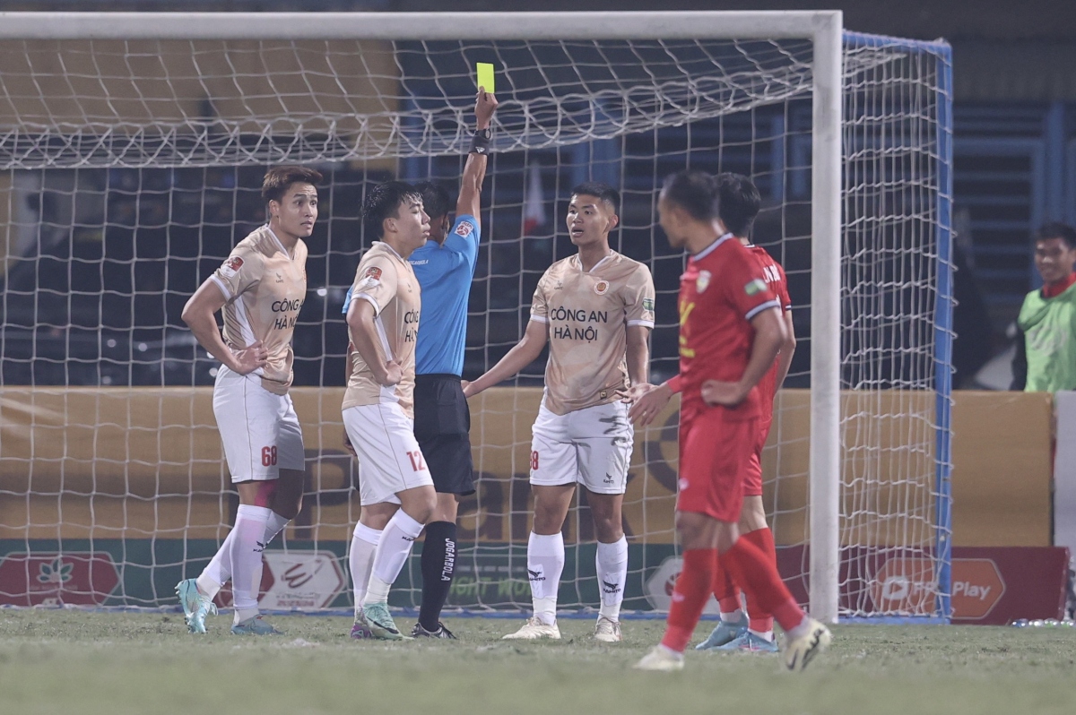 CLB CAHN vắng Giáp Tuấn Dương ở vòng 13 V-League. (Ảnh: VPF).