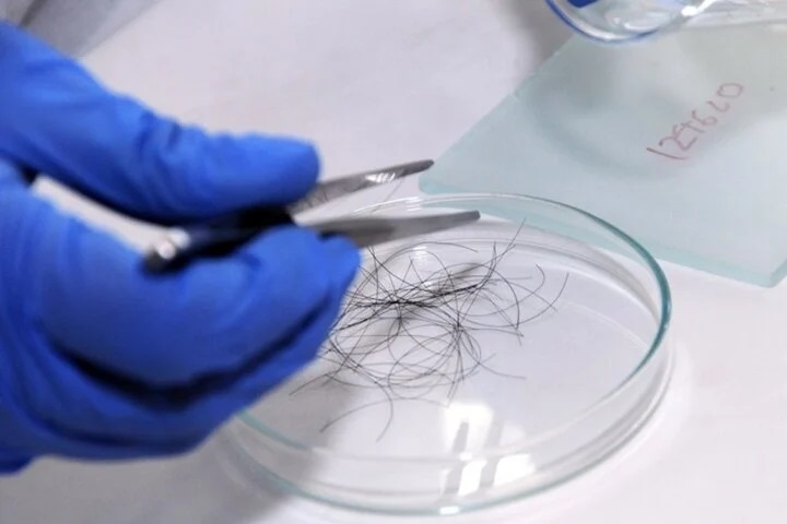 Nếu muốn xét nghiệm ADN chỉ cần có 10 sợi tóc có đủ chân, hoặc móng tay hay mẫu máu. (Ảnh minh họa)
