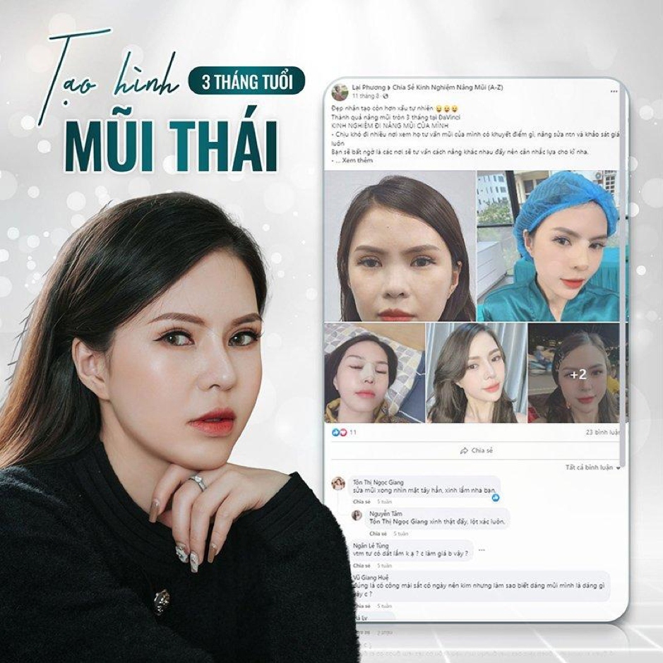 (KH nhận xét về dịch vụ tại thẩm mỹ viện DaVinci)