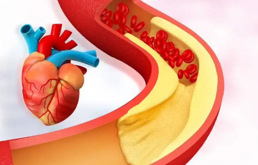 Ảnh: h2hcardiacphysio