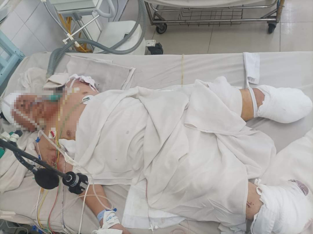 Anh Lưu đang được điều trị tại Bệnh viện Đa khoa tỉnh Bình Dương (Ảnh: ĐC)