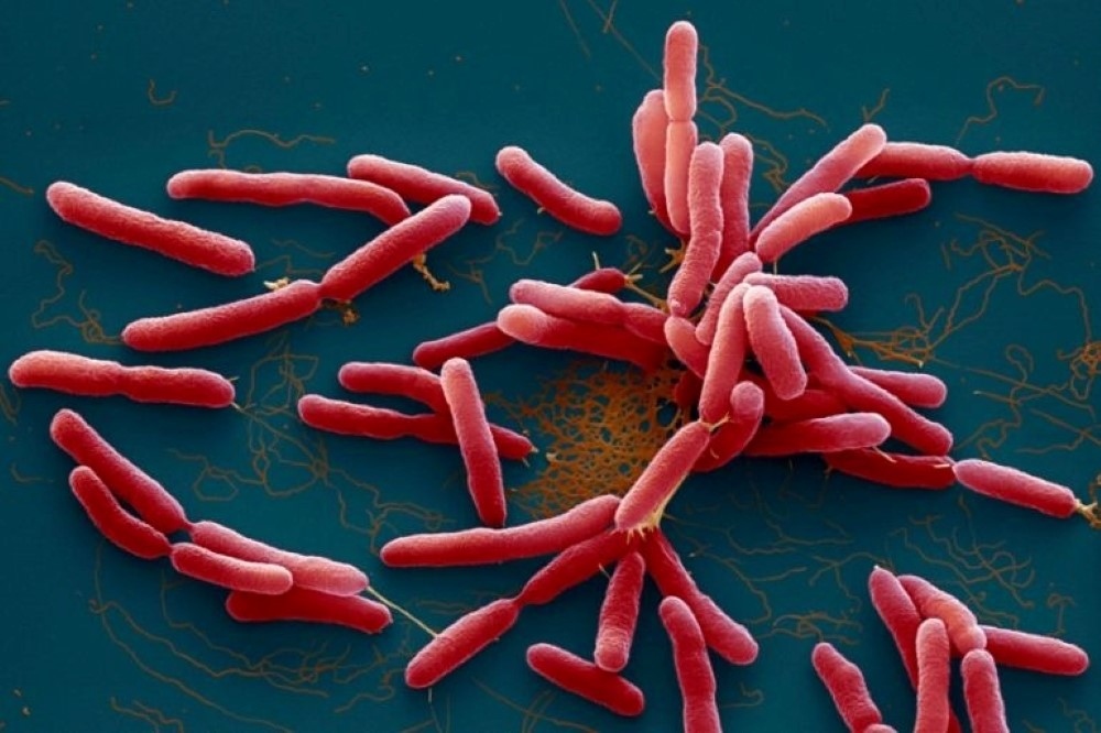 Bệnh Whitmore do vi khuẩn Burkholderia pseudomallei gây ra. Ảnh: Getty Images