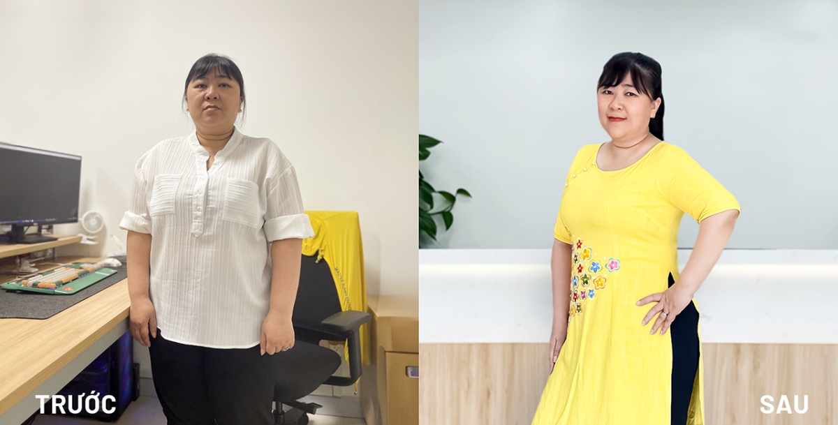 Hình ảnh chị Lương Thị Loan Thanh 45 tuổi, sau 2,5 tháng điều trị giảm cân tại “rung tâm kiểm soát cân nặng và điều trị béo phì hệ thống BVĐK Tâm Anh. Chị hết rối loạn đường huyết, hết đau khớp gối, hết trào ngược dạ dày, gan nhiễm mỡ chỉ còn độ 1. Chị thay toàn bộ quần áo từ size XXL về size L