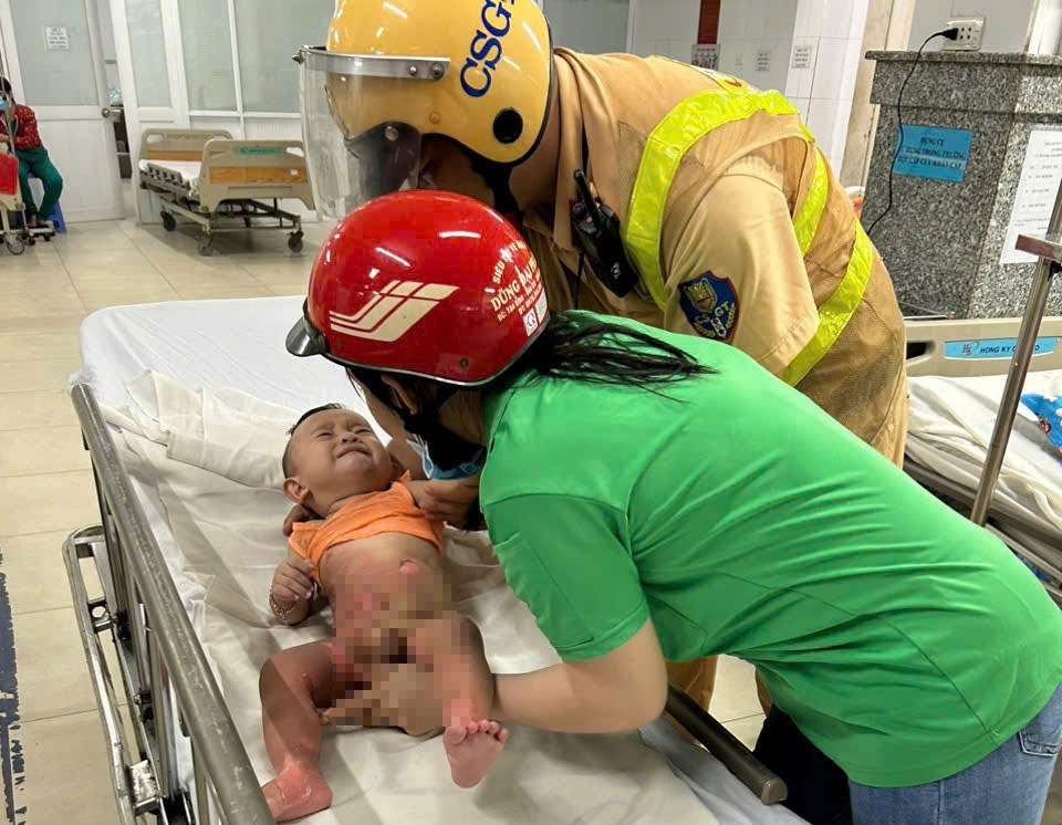Bé trai bị bỏng được cảnh sát giao thông hỗ trợ đưa đến bệnh viện (ảnh: CA)