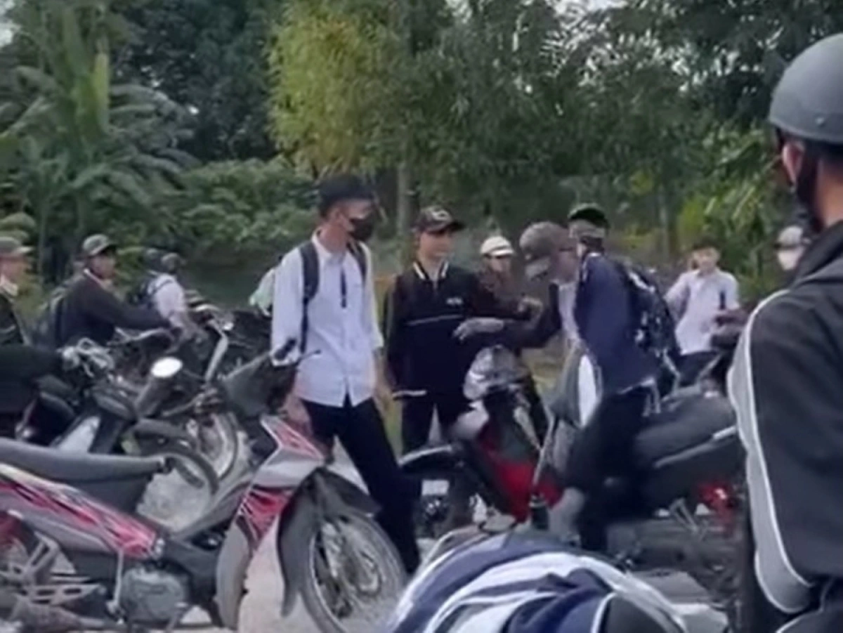 Nam sinh (ngồi trên xe) bị bạn đánh thâm mắt