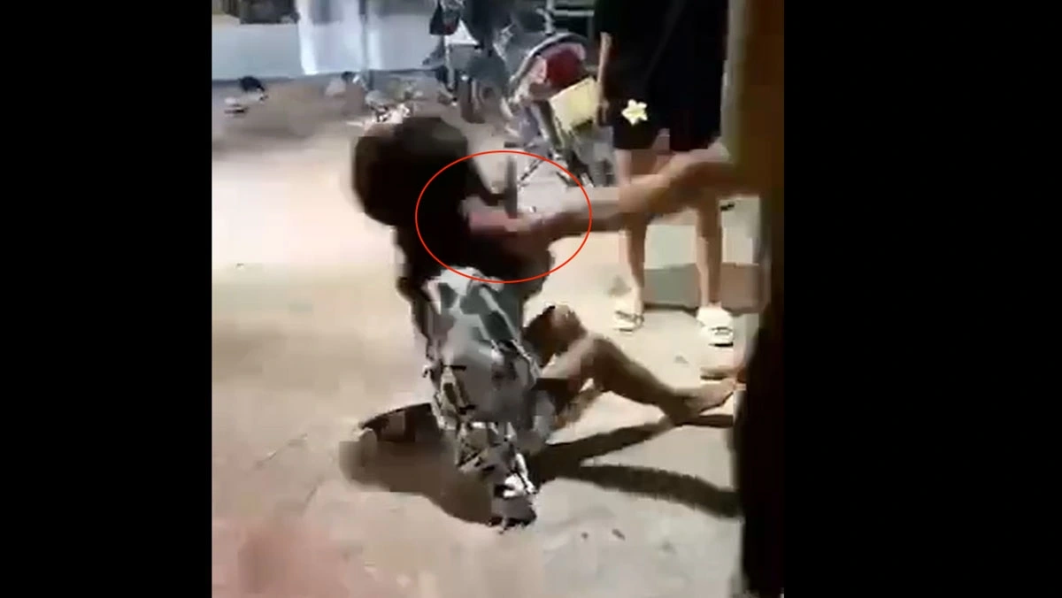 V. bị đá gãy răng (ảnh cắt từ video)