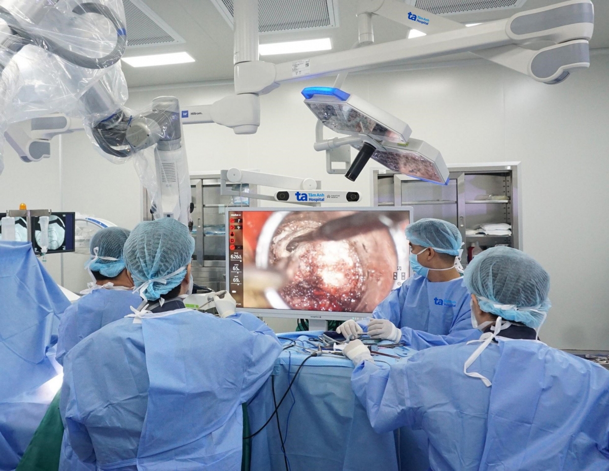 Ê kíp bác sĩ Khoa Phẫu thuật Thần Kinh, Bệnh viện Đa khoa Tâm Anh TP.HCM đang phẫu thuật u tủy sống bằng Robot Modus V Synaptive. Ảnh: Bệnh viện Đa khoa Tâm Anh TP.HCM