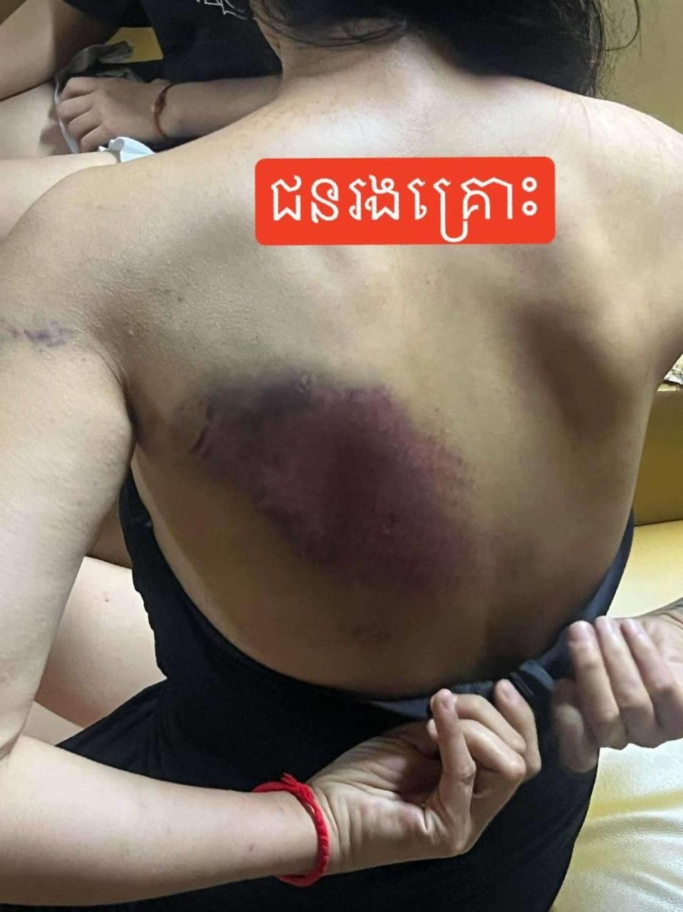 Nạn nhân (Ảnh: Fresh News)