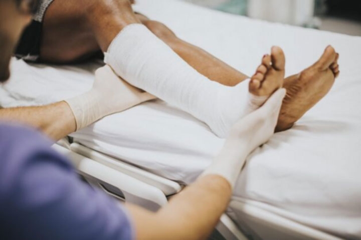 Người bị gãy xương cần được sơ cứu đúng cách để việc điều trị trở nên thuận lợi (Ảnh minh hoạ)