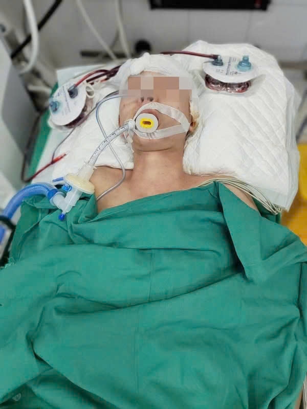 Nam thanh niên là L.V.D, 20 tuổi điều trị tại Bệnh viện Việt Đức