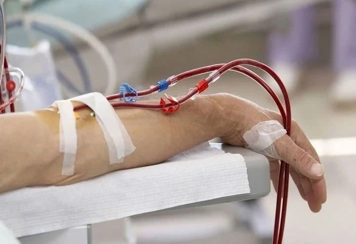 lọc máu rất tốt với điều kiện dành cho trường hợp cấp cứu và dành cho những trường hợp bệnh nhân bệnh lý