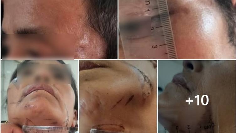 Các vết thương tích của 2 nạn nhân. Ảnh gia đình nạn nhân cung cấp