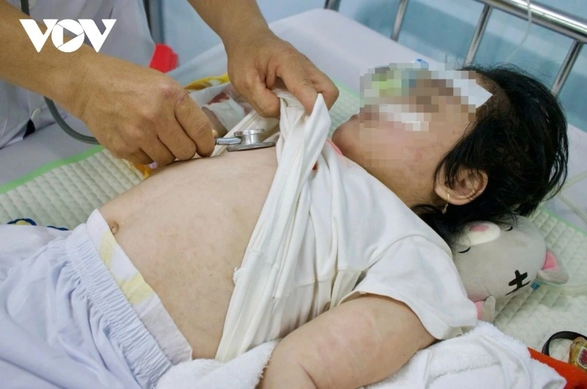 Dịch sởi có xu hướng gia tăng nhanh chóng, đặc biệt tại khu vực phía Bắc (Ảnh minh họa)