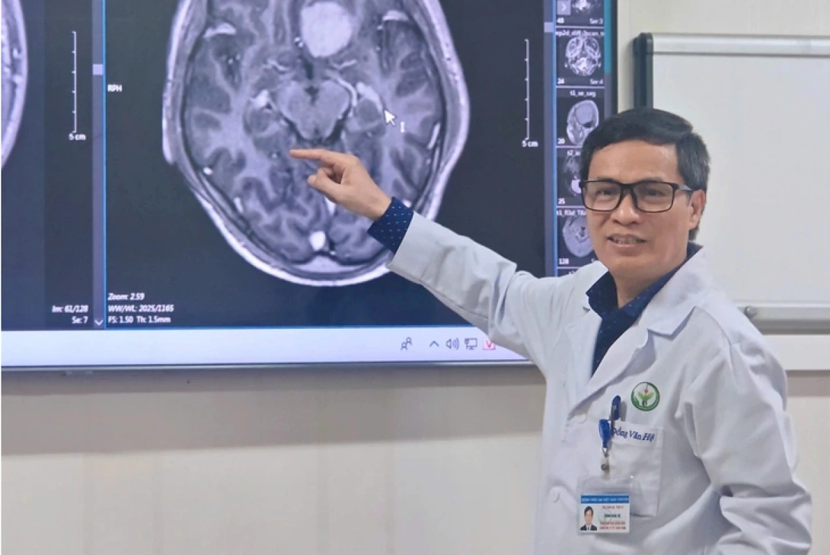 PGS.TS Đồng Văn Hệ chia sẻ về ca phẫu thuật nội soi qua cung mày cắt bỏ khối u não lần đầu tiên được thực hiện tại Việt Nam