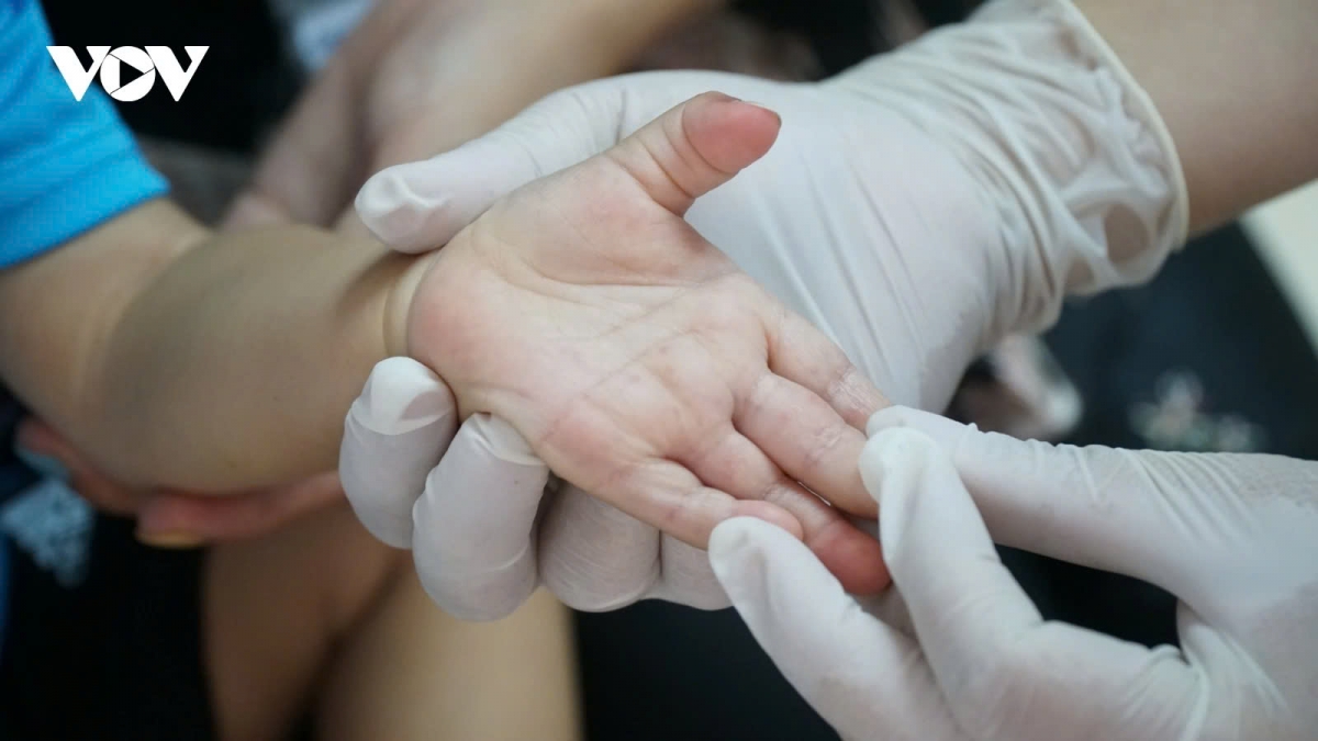 Bệnh tay chân miệng là bệnh nhiễm virus cấp tính, lây truyền theo đường tiêu hóa, thường gặp ở trẻ nhỏ đặc biệt là trẻ dưới 5 tuổi