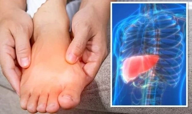 Nhiều dấu hiệu ở chân cảnh báo xơ gan nhưng không phải ai cũng biết. Ảnh: Daily Express