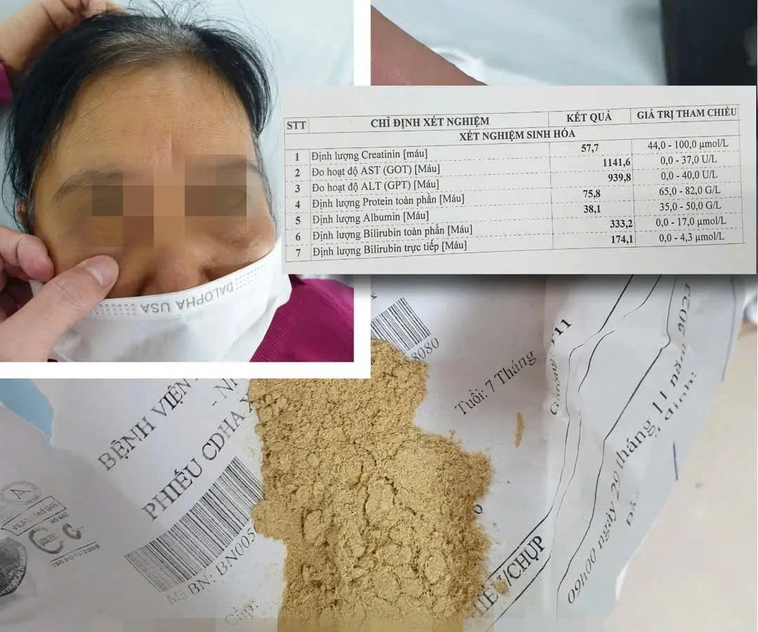 Bà cụ 70 tuổi sử dụng thuốc chứa chất cấm được bán trôi nổi trên mạng xã hội