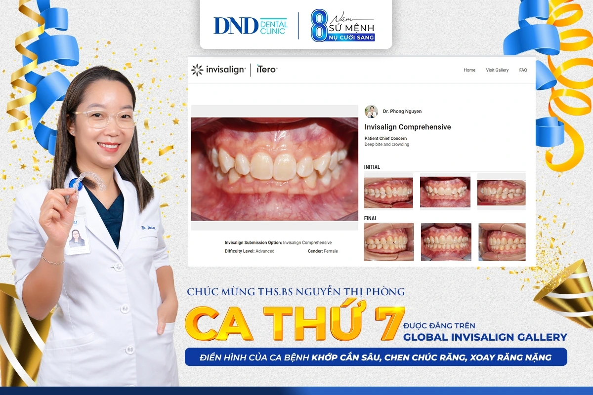 Ths Bs Nguyễn Thị Phòng là bác sĩ hiếm hoi tại Việt Nam có 7 ca điều trị xuất sắc được đăng trên trang Global Invisalign Gallery