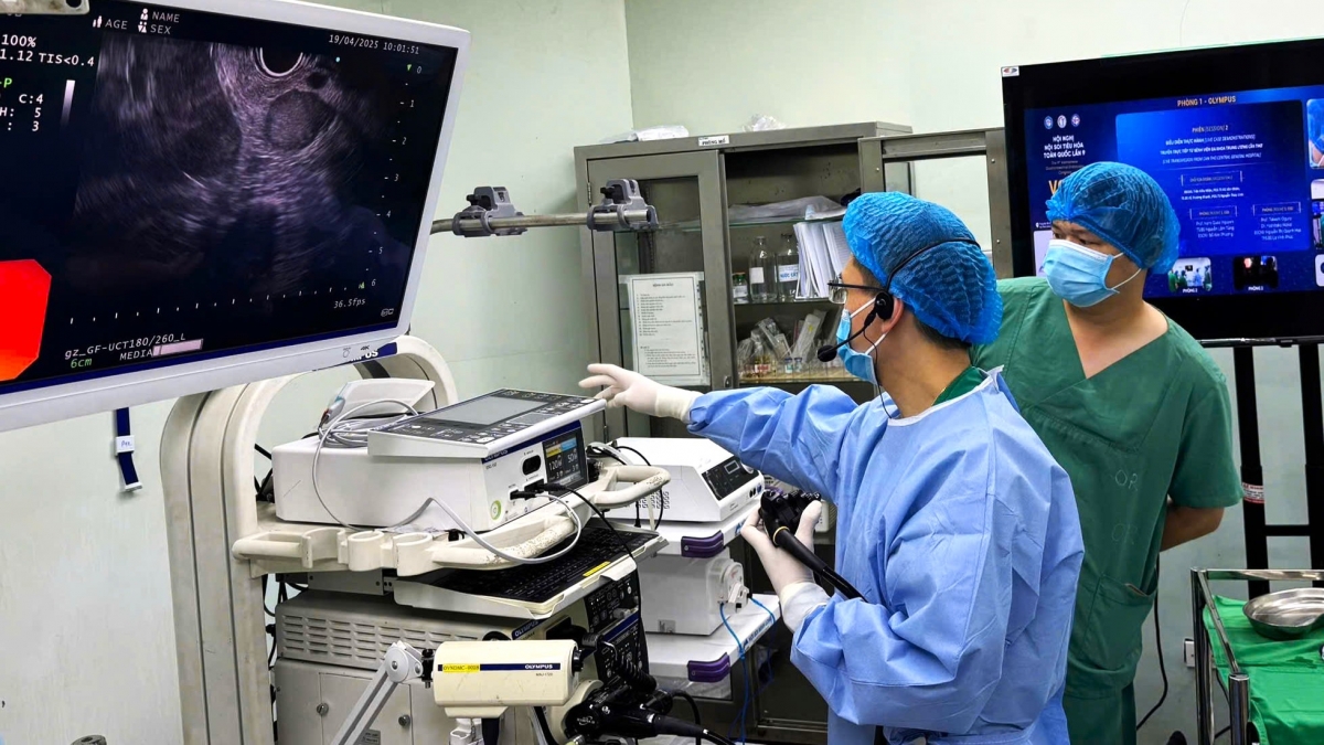 Dưới sự hướng dẫn của các chuyên gia, ekip bác sĩ Bệnh viện Đa khoa Trung ương Cần Thơ thực hiện thành công 11 trường hợp nội soi siêu âm chẩn đoán, 2 trường hợp u tụy thực hiện nội soi mật tụy ngược dòng đặt stent dẫn lưu mật, 1 trường hợp dùng SpyGlass tán sỏi do nhiều sỏi và sỏi to,…