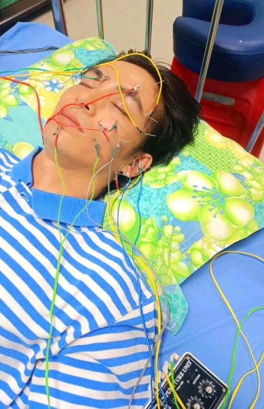 Lãnh Thanh bị liệt dây thần kinh số 7 bên mặt trái do trúng gió, đang điều trị châm cứu