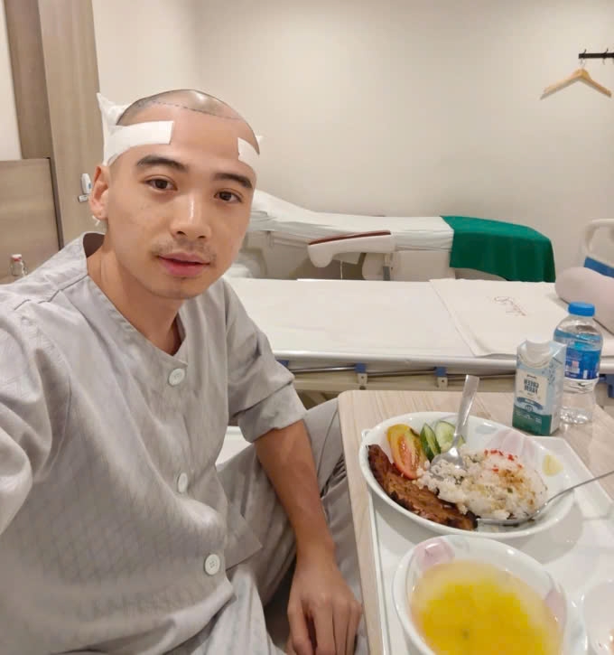 H'Hen Niê đăng ảnh ông xã Tuấn Khôi đang nghỉ ngơi, tẩm bổ trước khi bước vào quy trình cấy tóc. Người đẹp 33 tuổi cho biết Tuấn Khôi đã lấy xong nang tóc mà không thấy đau nên cô tạm thời yên tâm. (Nguồn: FBNV)
